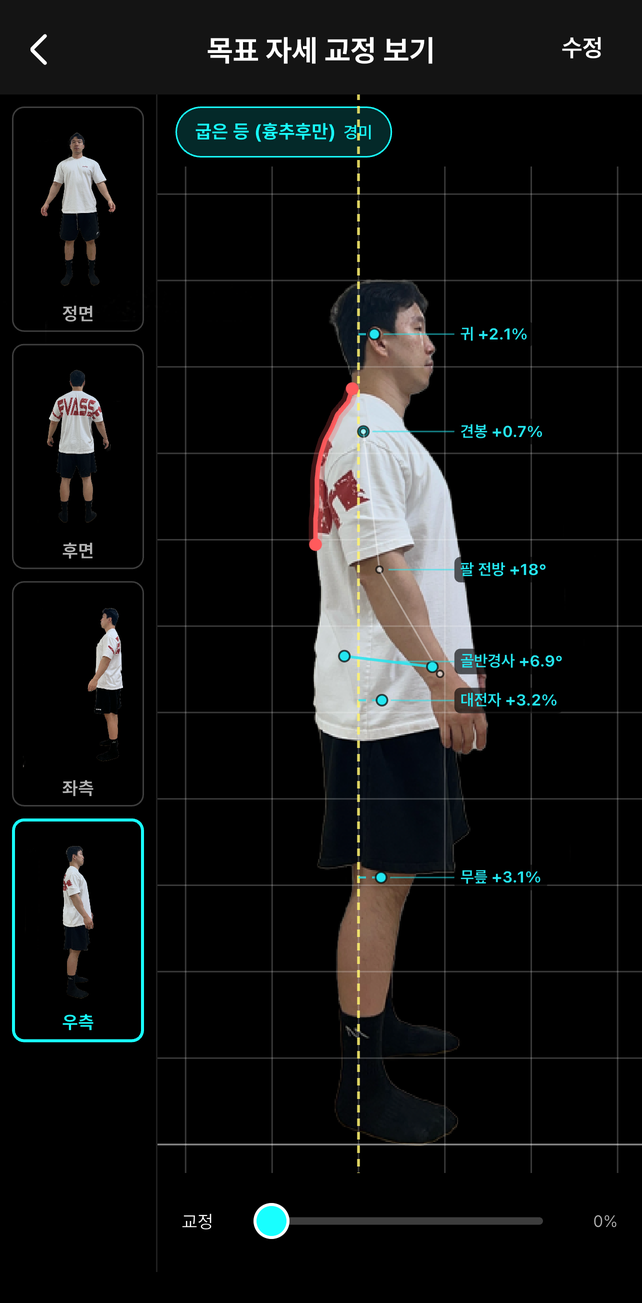 측면 자세 스캔